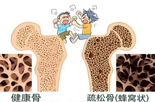 总觉得身体在垮掉？测测你的骨骼健康是否已陷入衰老危机？