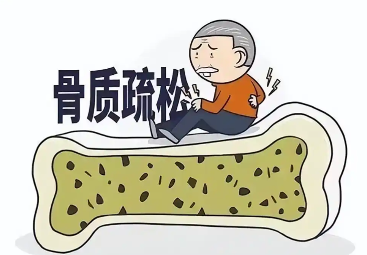 3大心理信号暗示骨骼变脆，1分钟测出你的骨质疏松风险